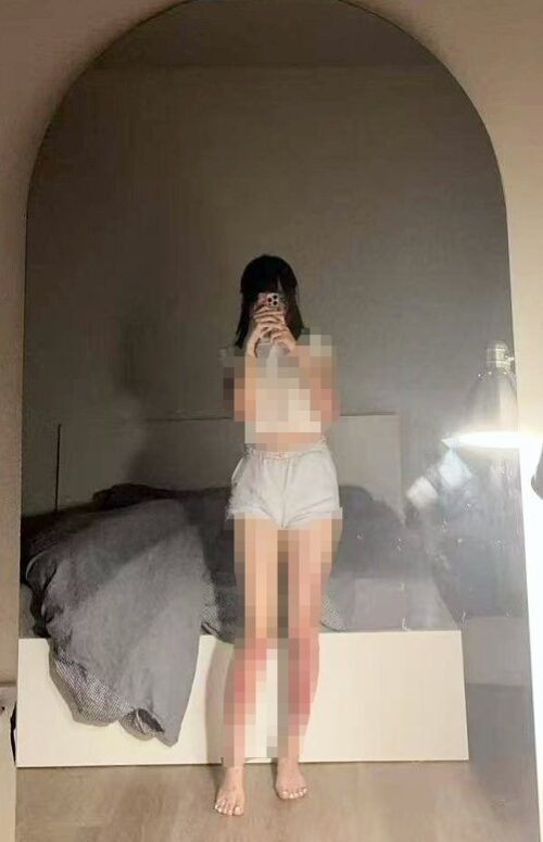 【画像】中国のパパ活女子(15)、セックスしすぎた結果とんでもないことに…
